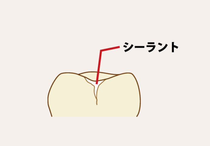 お子様に微笑みかける歯科衛生士