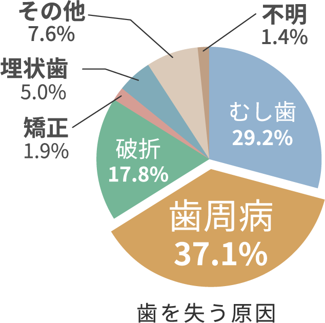 歯を失う原因 歯周病37.1%、虫歯29.2%、破折17.8%、埋伏歯5%、矯正1.9%、その他7.6%、不明1.4%